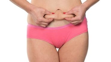 Cellulite reduction 