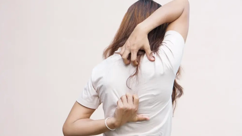 Itchy back symptons, causes and treatments